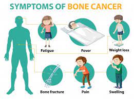 Pain is usually the first symptom of bone cancer. Free Vector Medical Infographic Of Bone Cancer Symptoms