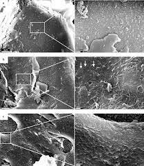 Check spelling or type a new query. Sem Images Of Pretreated Spruce Wood Chips A After Steam Pretreatment Download Scientific Diagram