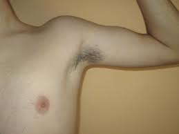 File:Teen boy armpit.JPG - Wikipedia