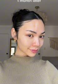 Tiffany Ma Before and After