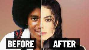 L'évolution de l'apparence de Michael Jackson : un voyage à travers les  procédures cosmétiques
