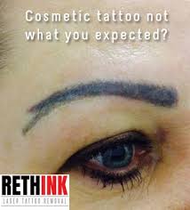 Sorted by recently answered 22 questions. Cosmetic Tattoo Removal