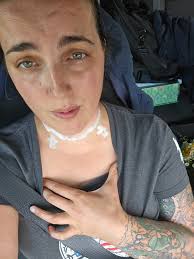 What were your Tg levels before pill?