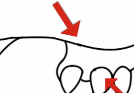 Der zwischen zahnfleisch und zahn ist meist zwischen 0,5 und 2 millimetern tief. Outlines Mit Dem Curve Tool Zeichnen Von Yunuyei Clip Studio Tips