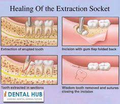 Pin On Dental
