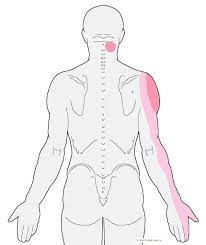 Pin On Trigger Points