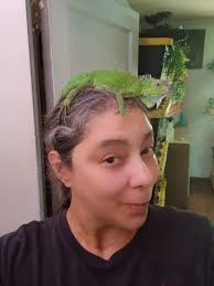 Itchy hair accessory problem