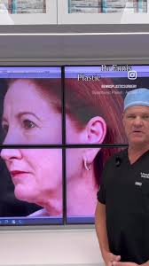 ✨ Vertical Rejuvenation, Redefined ✨ Dr. Ennis breaks down how a Modified  Temporal Brow Lift, Lower Blepharoplasty, and Deep Plane Facelift work  together to create a true vertical lift across the ...