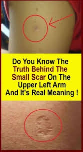 Do You Know The Truth Behind The Small Scar On The Upper Left Arm And It S Real Meaning In 2020 Healthy Lifestyle Quotes New Quotes Know The Truth