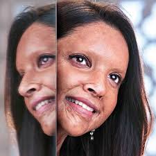 Deepika Padukone S First Look As The Acid Attack Survivor In Chhapaak Is Out See Pic Pinkvilla