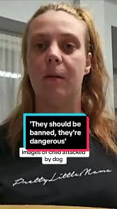 Mother Shares Emotional Account of Child's Dog Attack