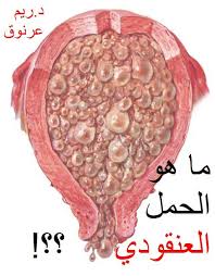 ما هو الحمل العنقودي حكيت لكم دكتورتي ريم عرنوق Facebook