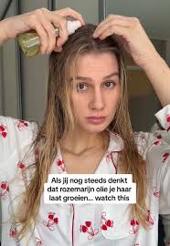 Review: tiny todd bij eczeem 🔥 #eczeem #eczeemflareup #tinytodd #tony...