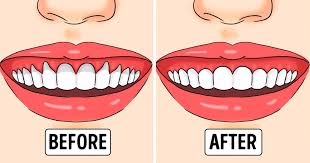If You Have Receding Or Unhealthy Gums Here Are Proven Solutions