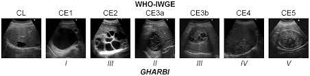 We did not find results for: Comparison Of Gharbi S And Who Iwge Ultrasound Classifications Of Ce Cysts