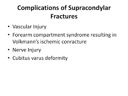 Image result for Fracture Complication