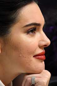 Kendall jenner has revealed her raw story. at 7:30 p.m. Pin By Daniela Marquez On Kendell Jenner Kendall Jenner Makeup Jenner Makeup Beauty Hacks