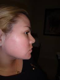 Melissa A. Bogle, MD, Board Certified Dermatologist