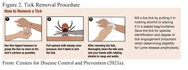 Image result for Tick Removal