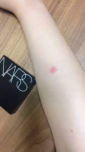 こま on twitter ちょっと見てnarsのクッションファンデvs腕の虫刺され https t co ec0oiqkx9c twitter triangle tattoo twitter sign up