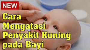 Bayi kuning adalah kondisi yang sering terjadi pada bayi baru lahir, dan sesuai dengan namanya ditandai oleh kulit dan mata bayi berwarna kekuningan. Bayi Kuning Inilah 4 Cara Mengatasi Dan Penyebab Demam Kuning Blog Birds Bees