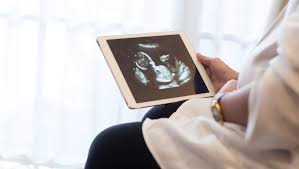 Maybe you would like to learn more about one of these? What To Expect When You Tell Your Boss You Re Expecting The Riveter