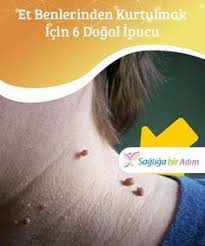 Et Benlerinden Kurtulmak Icin 6 Dogal Ipucu Ananas Suyunun Iltihap Sokucu Ve Antiviral Ozellikleri Beauty Hacks That Work Beauty Hacks Fuller Lips Naturally
