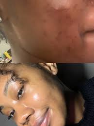 19 top Doorskin Matcha Dan Hada Labo ideas in 2024