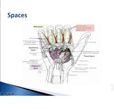 Hand Infections For The Frcsorth Orthopaedicprinciples Com