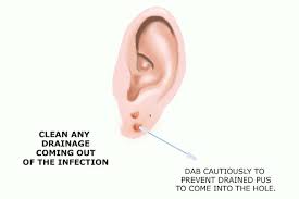 We've compiled some of the top tips below so you can say goodbye to. How To Fix Earring Holes That Stretched Stories Of Silver Silk
