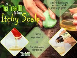 How To Get Rid Of Itchy Scalp Home Remedies Self Care Itchy Scalp Tea Tree Oil For Acne Tea Tree Oil