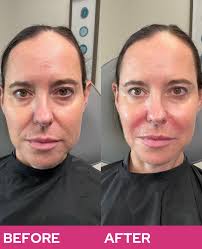 MACIE MONDAY 💕 Swipe for some of Macie's recent work! She's taking  appointments for filler, tox, HydraFacials, Derma PRP, and weight loss  consults