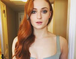 We read that you once tried to go from red back to your natural blonde and almost lost your hair. Sophie Turner Pets Celebrity Pet Worth