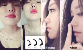 Women In Asia Insert Pegs Into Their Nose To Look European Daily Mail Online