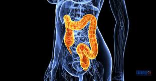 The colon, or large intestine, is a. Colorectal Cancer Symptoms Causes And Treatment Dr Nandi Charities