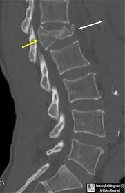 Pin By Excalibur Healthcare Www Ex On Excalibur Healthcare S Imaging Teleradiology Pins Radiology Radiography Radiologic Technology