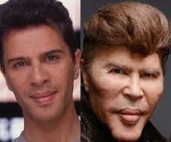 The media also said that because of her bad appearance, her career becomes downward. Plastic Surgeries Gone Wrong Before And After Pics 20 Bad Celebrity Plastic Surgery Plastic Surgery Gone Wrong Celebrity Plastic Surgery