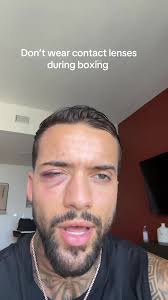 Georgemorcos1 Boxing Lost