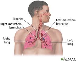 Asbestosis (genetic and rare diseases information center). Asbestosis Information Mount Sinai New York