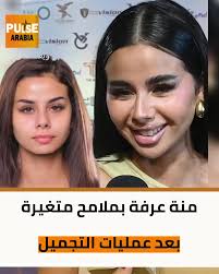 منة عرفة بملامح متغيرة بعد عمليات التجميل