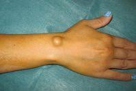 как избавиться от пигментных пятен на руках народными средствами Pin On Zdorove