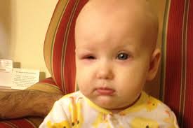 What You Need To Know To Help Your Child's Vision If They Have IP