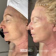 Norfolk Skin Atelier