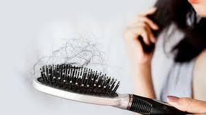 Hair loss isn't just a guy thing. Hair Loss Can Also Affect Women Maxim Hair Restoration