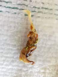 Urin Und Kottelkunde