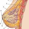 Signs and symptoms of male breast cancer can include: 1