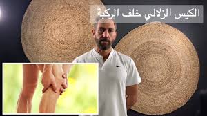 ٤٠ الكيس الزلالي خلف الركبة تمرين واحد كفيل بعلاج اكثر من ٩٠ بالمية من الحالات دون العمل الجراحي Youtube