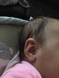 Piercing Baby Ears May 2017 Babies Forums What To Expect