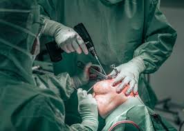 Orthopaedic care at Profrea