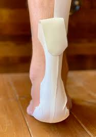Image result for Taping for Soleus and Achilles